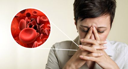 3 consejos para evitar la aparición de anemia