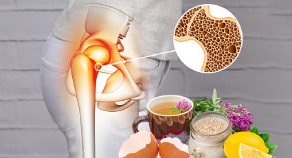 Los 3 remedios naturales y económicos para prevenir la osteoporosis