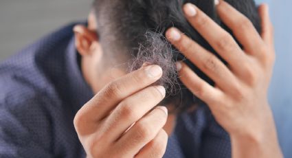 ¡Adiós a la alopecia! Haz crecer tu pelo en 2 semanas con este remedio casero con cebolla