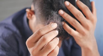 ¿Alopecia? Dile adiós a la caída de pelo usando solo 2 ingredientes naturales