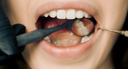 ¿Cómo curar las aftas de la boca SIN dolor? Remedio casero con 2 ingredientes de cocina
