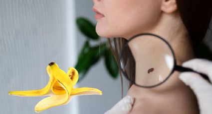 Conoce el truco perfecto para eliminar las verrugas en el cuello con cáscara de plátano