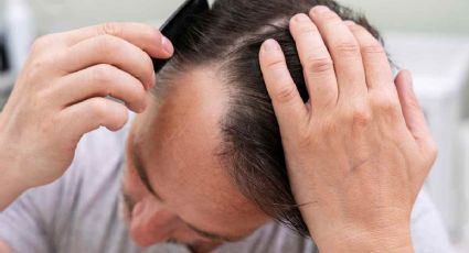 Dile adiós a la alopecia rápidamente con este tónico capilar hecho de 2 plantas aromáticas